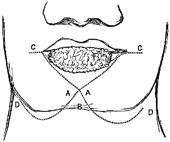 Fig. xxi.